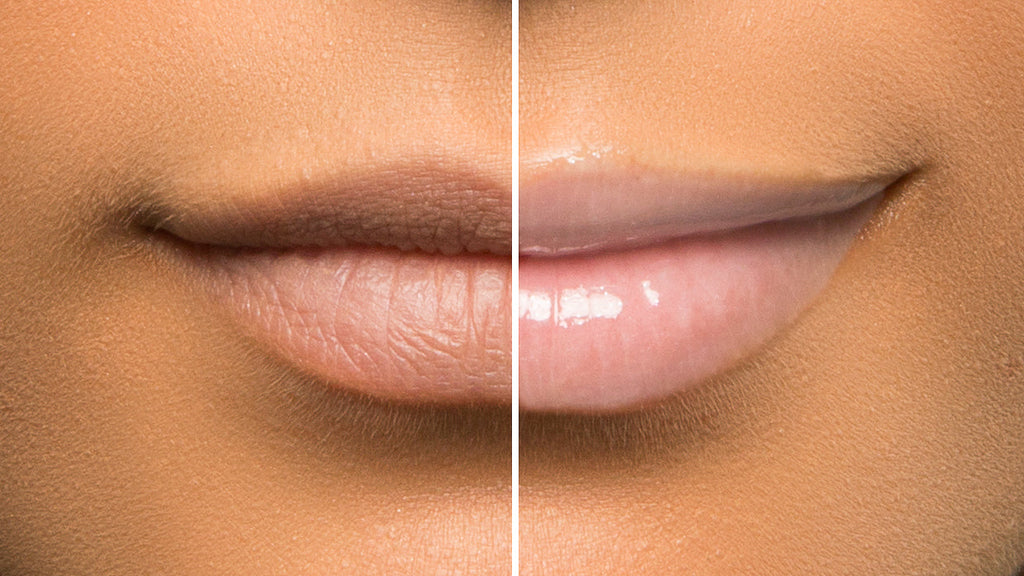 The Strawberry Kiss Kit Treatment Duo