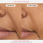 Bouncy Skin On The Go